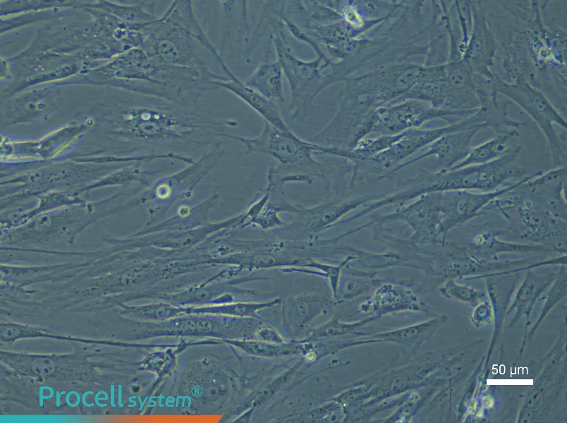 Mouse Pancreatic Stellate Cell Complete Medium - small - 4