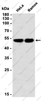 Recombinant CUG BP1 Monoclonal Antibody - 2