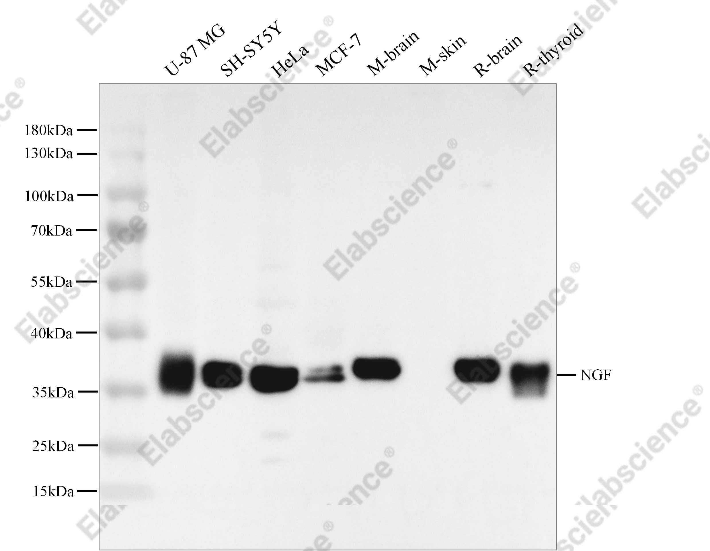 Recombinant NGF/NGFB Monoclonal Antibody - 1
