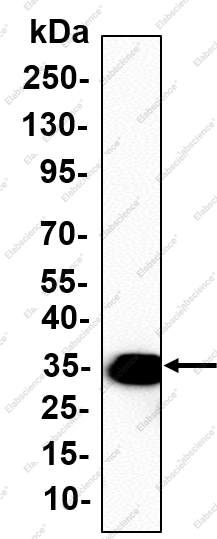 Recombinant Pim-1 Monoclonal Antibody - 1