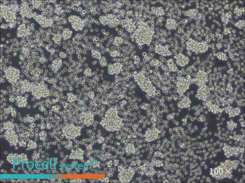 WSU-DLCL2 Cell Complete Medium - 1