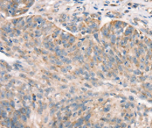 DECR1 Polyclonal Antibody - 2