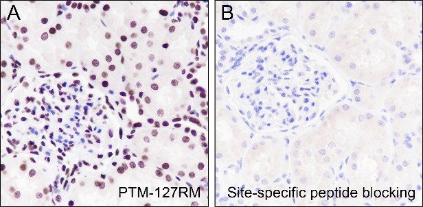 Recombinant Histone H4 (Acetyl Lys77) Monoclonal Antibody-searchlist-3