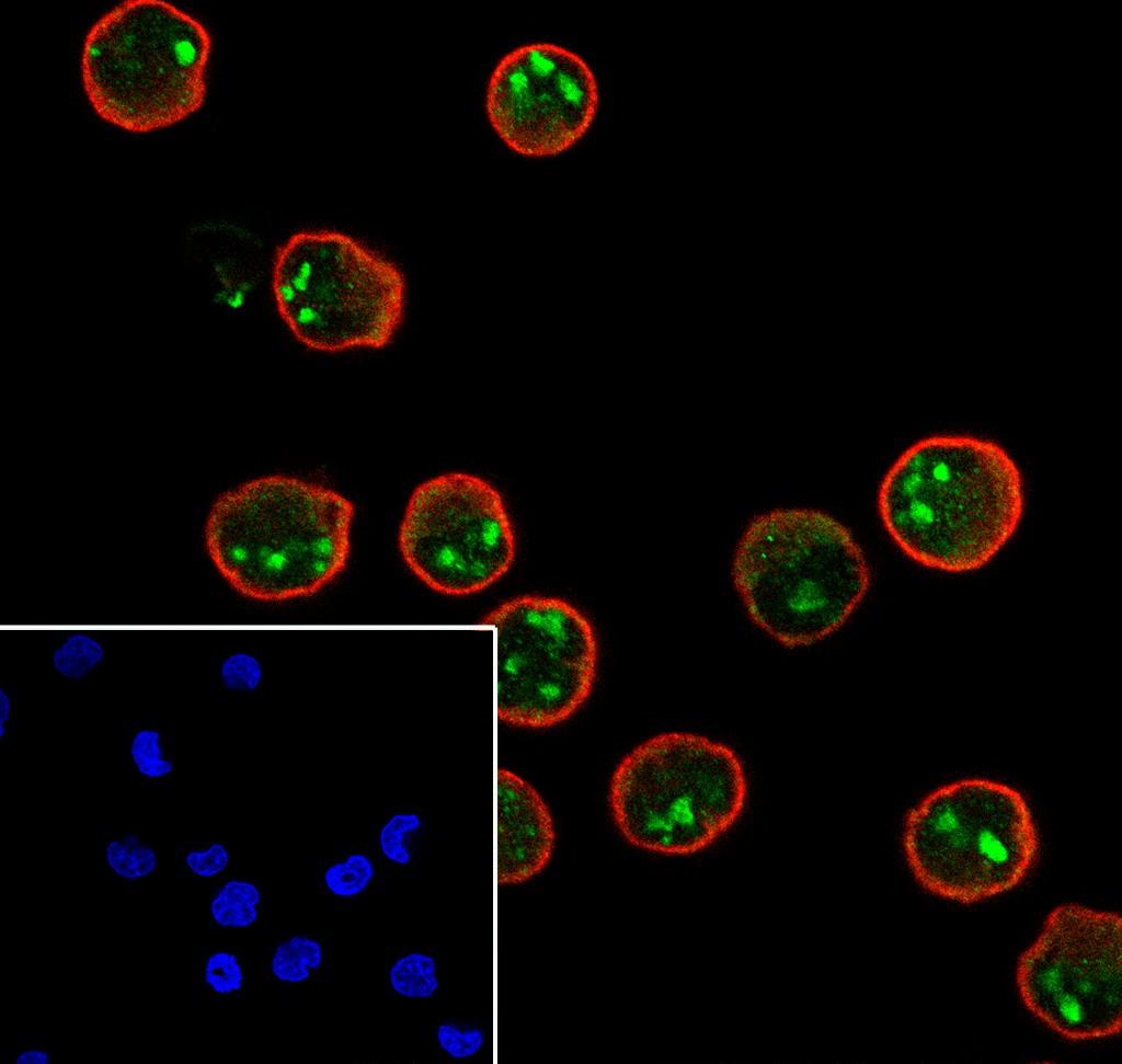 Recombinant TOP3B Monoclonal Antibody - small - 2