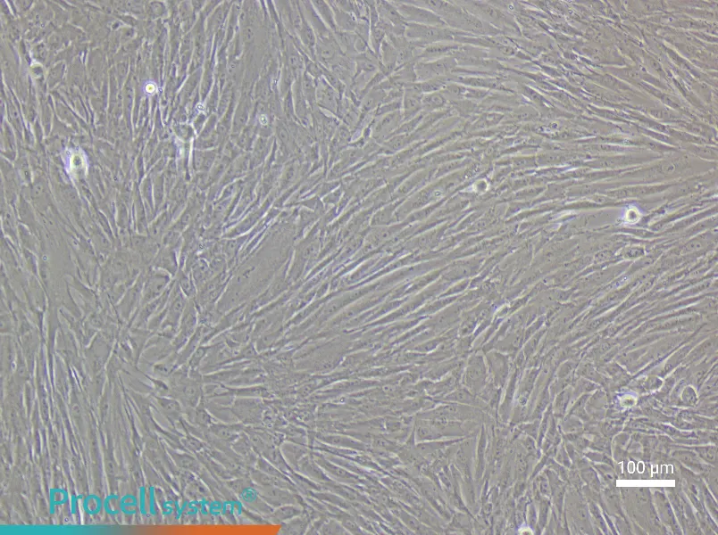 Human Esophageal Fibroblast Complete Medium - 3