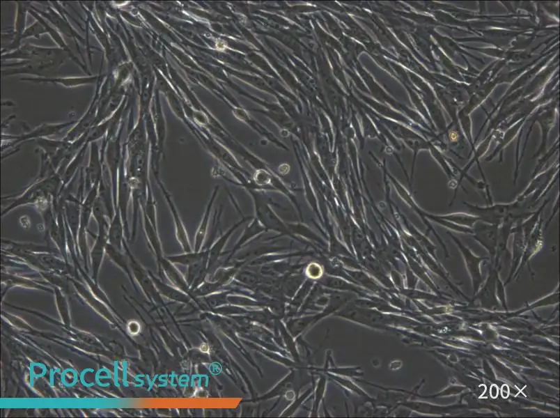 MeWo Cell Complete Medium - small - 4