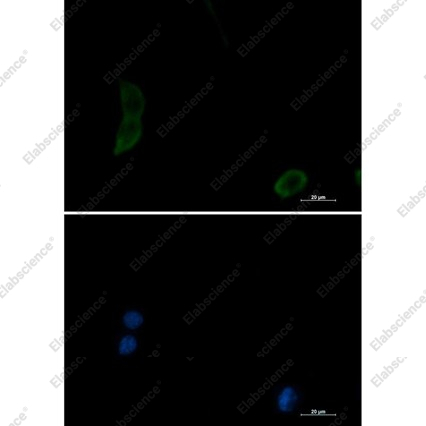 Recombinant PKN1 Monoclonal Antibody - 3