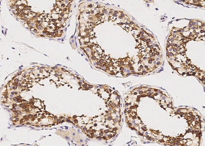 Recombinant GDF-3 Monoclonal Antibody-searchlist-1