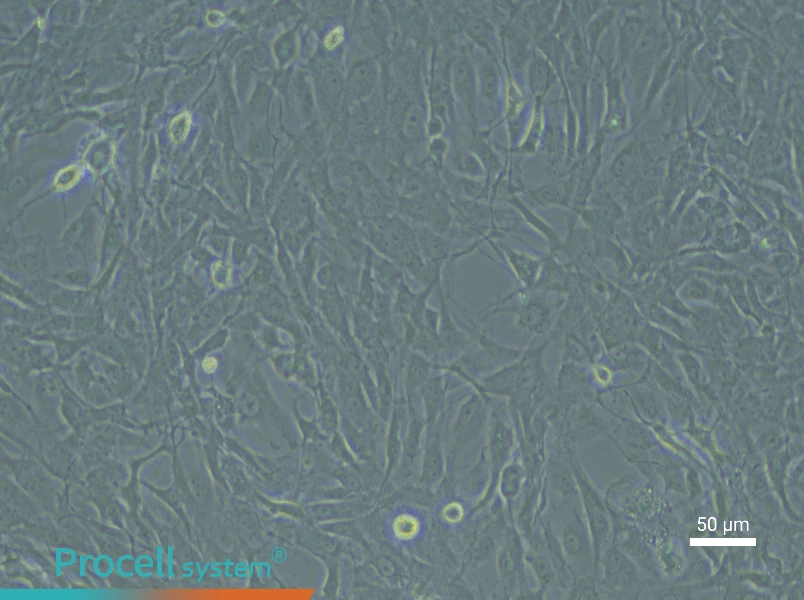 Rat Meningeal Fibroblast Complete Medium - 6