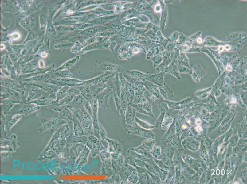 NCI-H647 Cell Complete Medium - 6