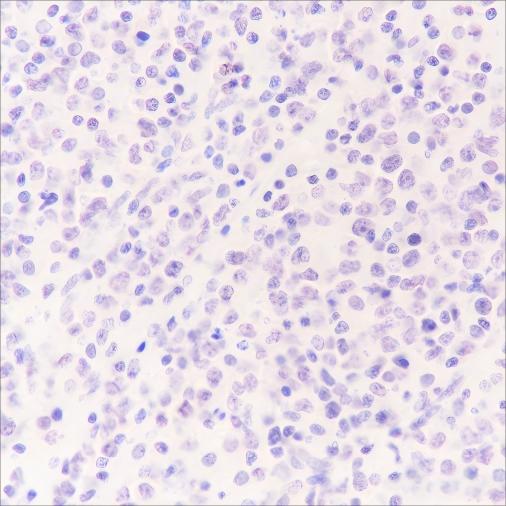 Recombinant SOX11 Monoclonal Antibody - 2