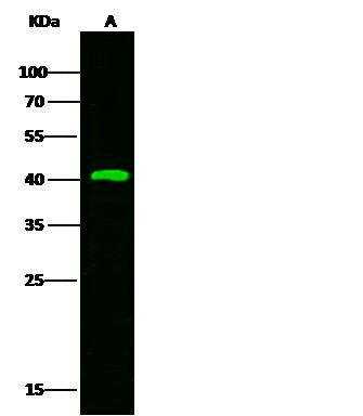 Recombinant KLK-11/Kallikrein-11 Monoclonal Antibody - small - 2