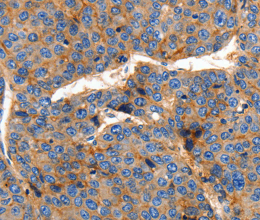 Claudin 1 Polyclonal Antibody - 2