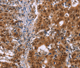 CBX3 Polyclonal Antibody - 2
