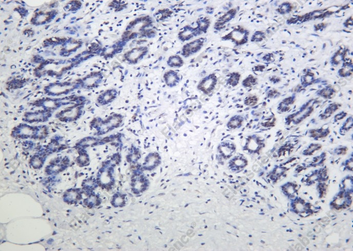 Recombinant Phospho-p53 (Ser46) Monoclonal Antibody - 2