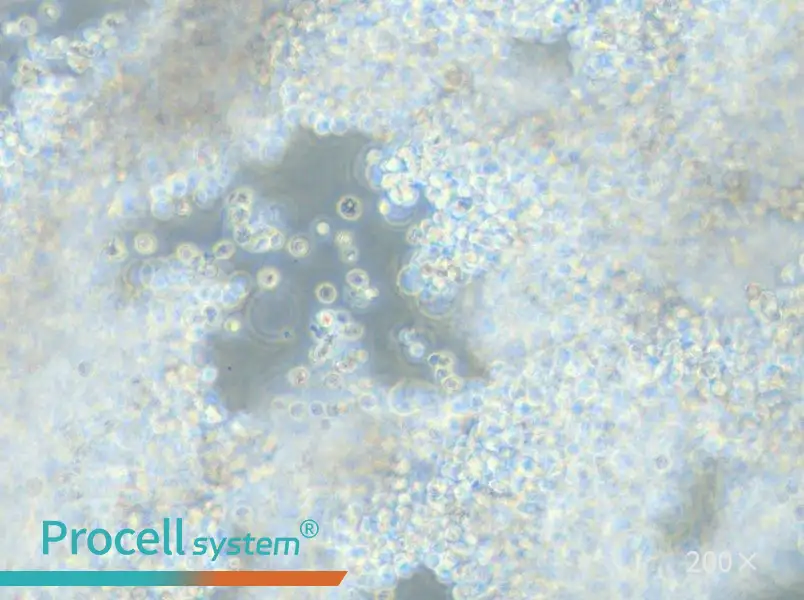 NCI-H2171 Cell Complete Medium - 5