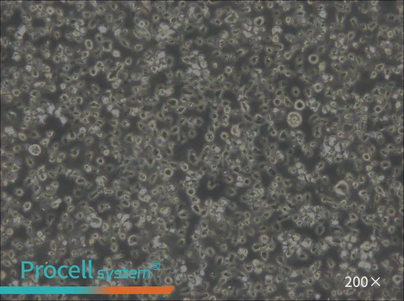 MEC-1 Cell Complete Medium - 5