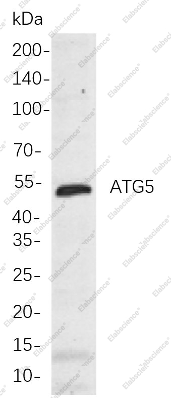 Recombinant ATG5 Monoclonal Antibody - 1