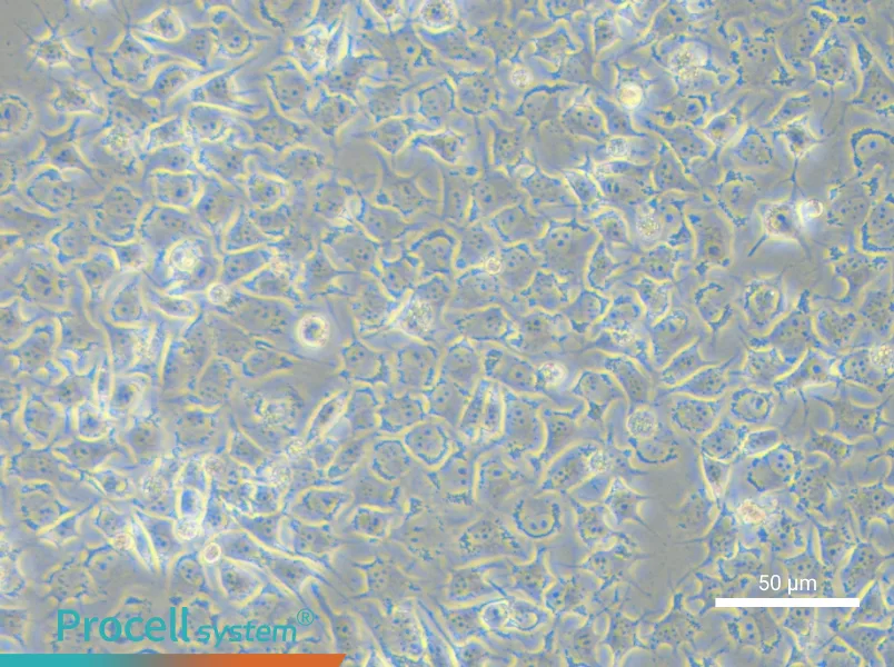 92-1 [Human uveal melanoma] - 5