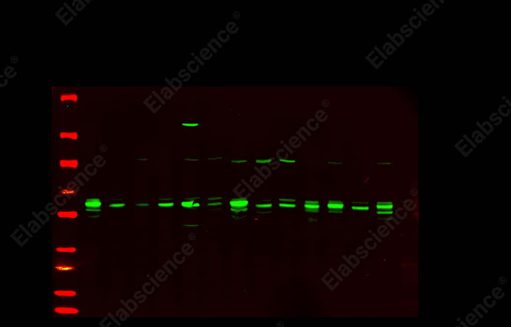 Recombinant SQSTM1/p62 Monoclonal Antibody - 3