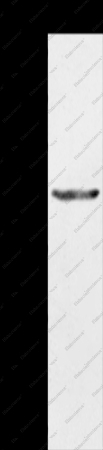 KRT31 Polyclonal Antibody - 1
