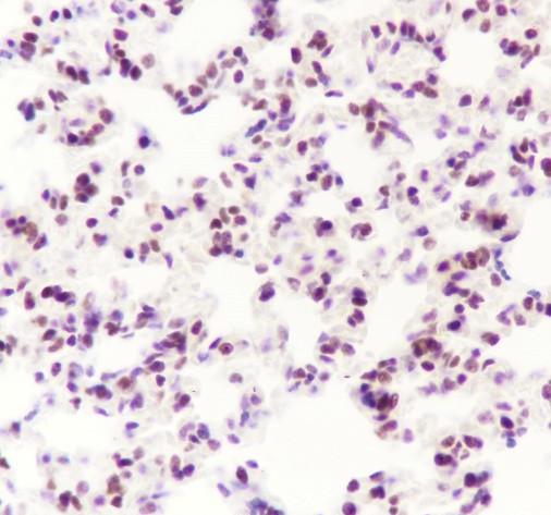 Recombinant RING1B Monoclonal Antibody - small - 4