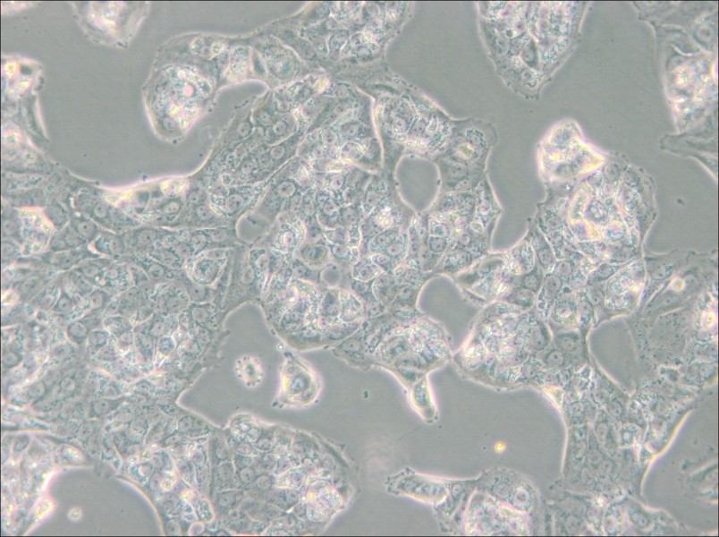 MDA-MB-175VII (DMEM) Cell Complete Medium - 5