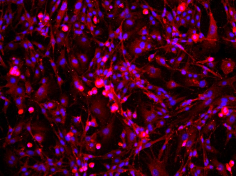 Mouse Cavernous Endothelial Cell Complete Medium-searchlist-1
