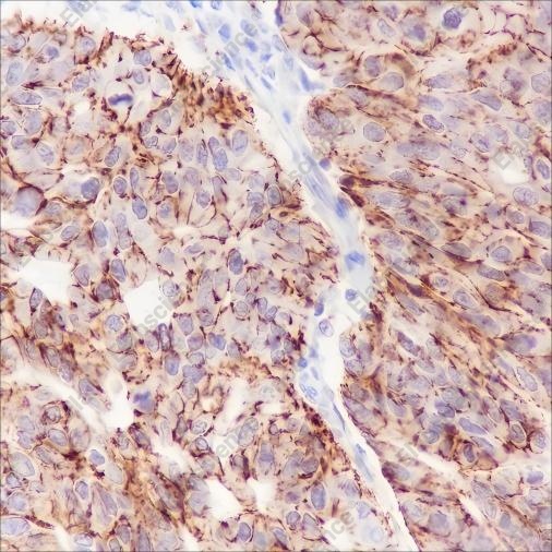 Recombinant Claudin-7 Monoclonal Antibody - 2
