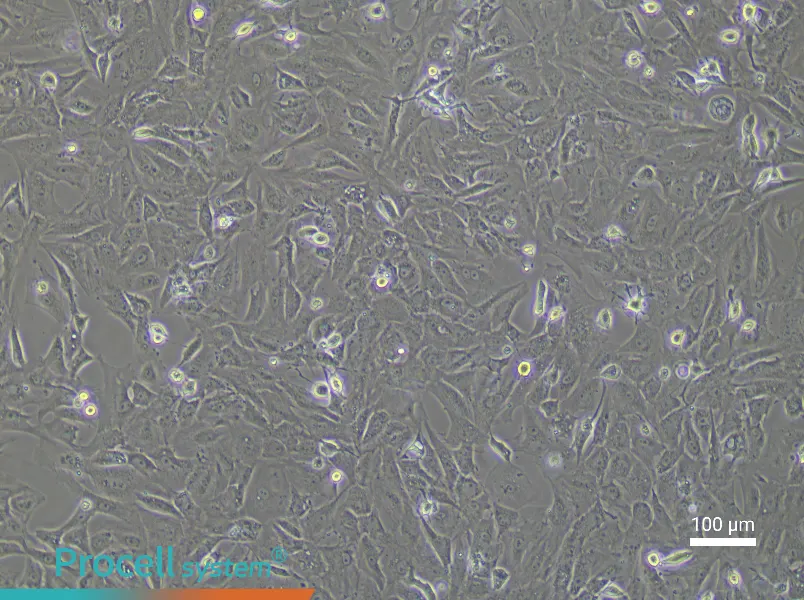 Rat Cardiac Fibroblast Complete Medium - 3