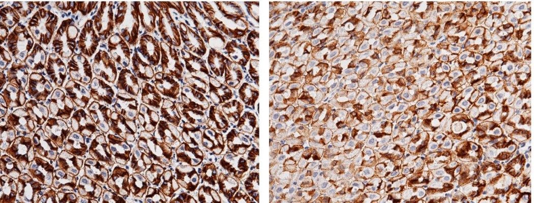 Recombinant Carbonic Anhydrase IX/Car9 Monoclonal Antibody-searchlist-1