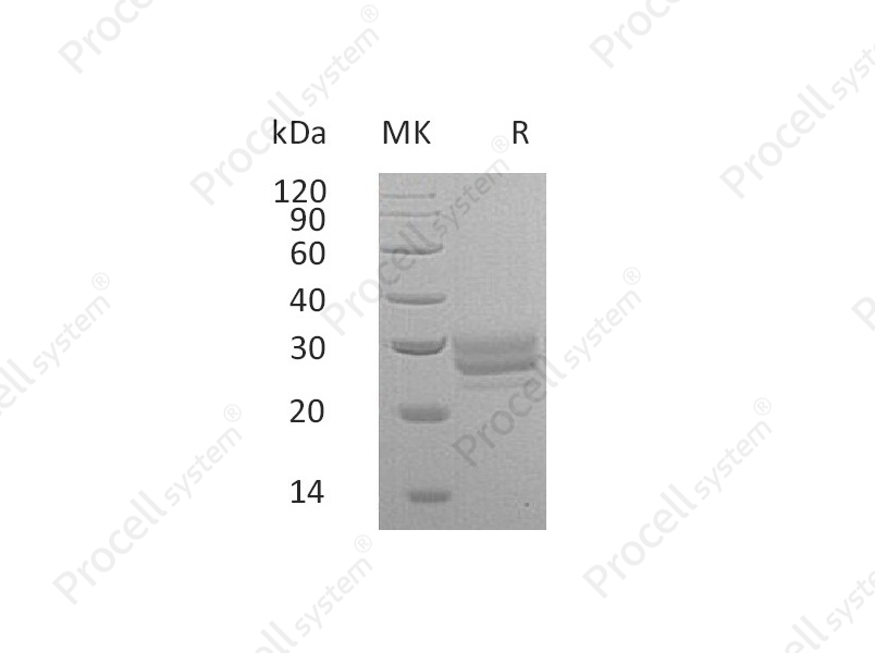 Flt-3L/Flt3LG (C-6His), Mouse, Recombinant
