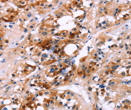 CALB1 Polyclonal Antibody - 2