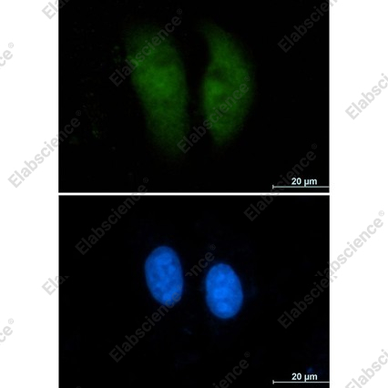 Recombinant GST3 Monoclonal Antibody - 3