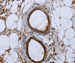 FBP1 Polyclonal Antibody - 3