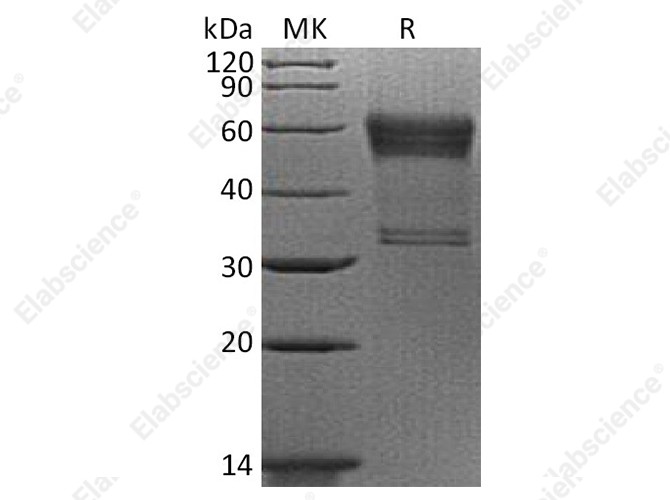 Recombinant Human 4-1BB/TNFRSF9 Protein (mFc Tag) - 1