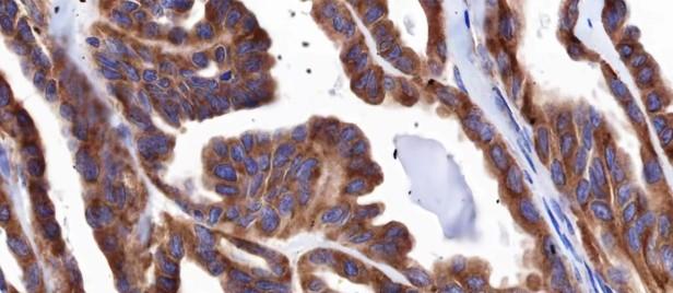 Recombinant IGF2R/CI-M6PR Monoclonal Antibody-searchlist-3