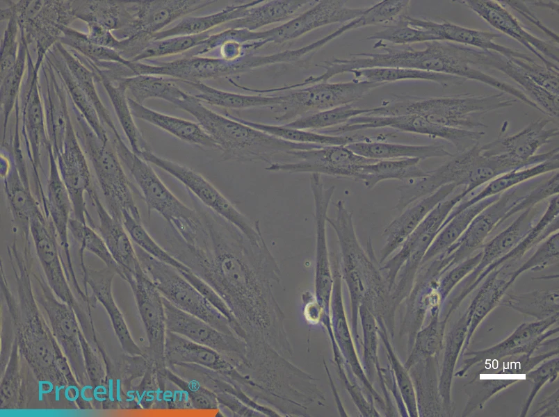 Human Colonic Fibroblast Complete Medium - 5