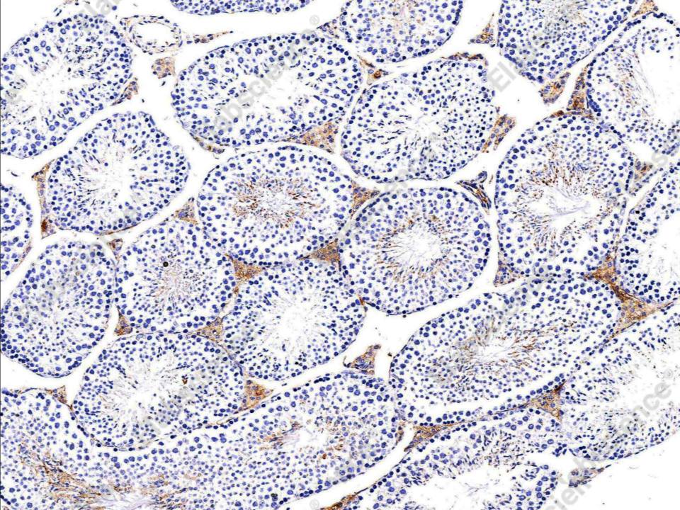 Recombinant CLEC3B/Tetranectin Monoclonal Antibody - 1