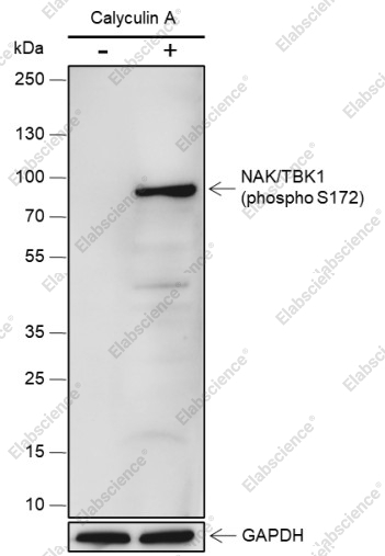 Recombinant Phospho-TBK1/NAK (Ser172) Monoclonal Antibody - 2