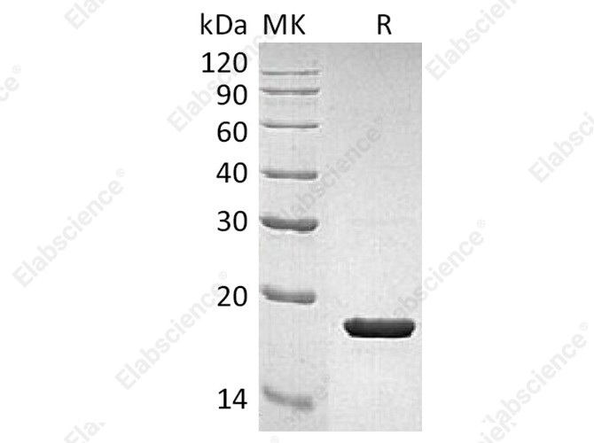Recombinant Human IL-1RA/IL1RN Protein - 1
