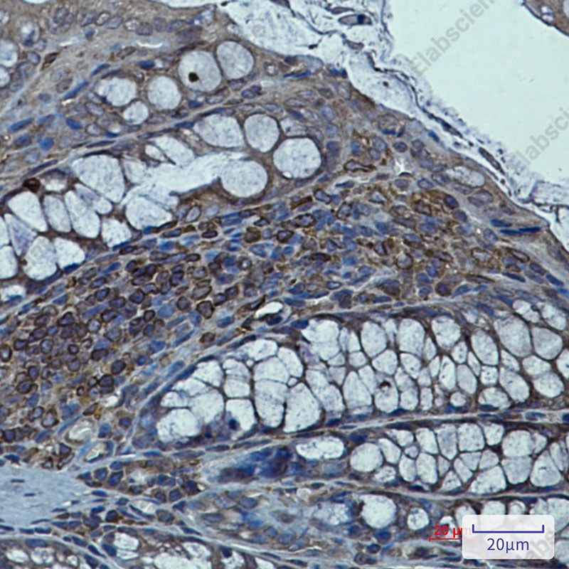 Recombinant Syntrophin alpha 1 Monoclonal Antibody - 3