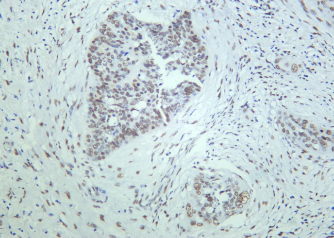 Recombinant 53BP1 Monoclonal Antibody - small - 2