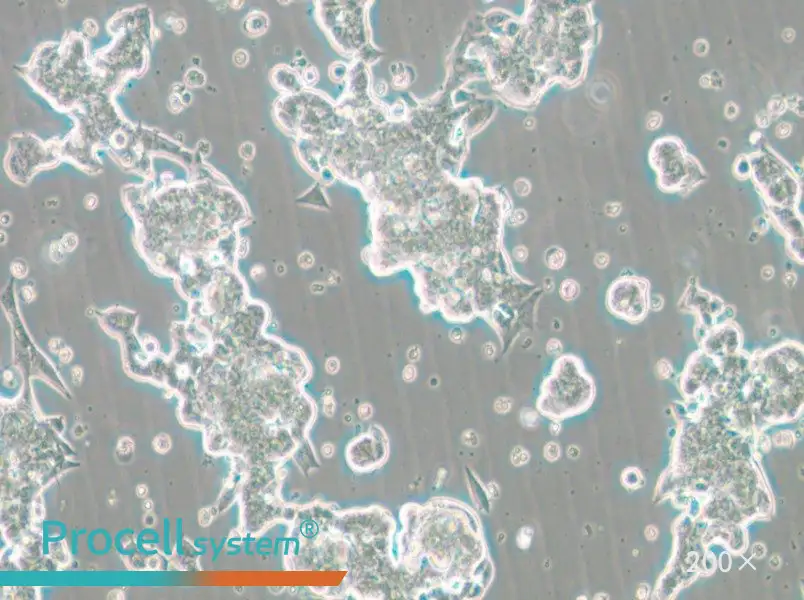 NCI-H209 [H209] Cell Complete Medium - small - 6