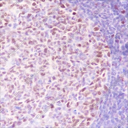 Recombinant MCM3 Monoclonal Antibody - 3