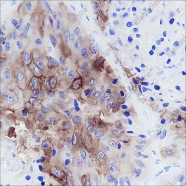 Recombinant TROP2 Monoclonal Antibody - 4