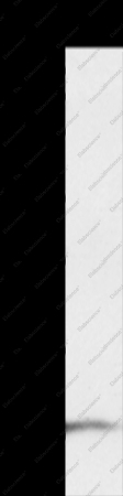 S100P Polyclonal Antibody - 1