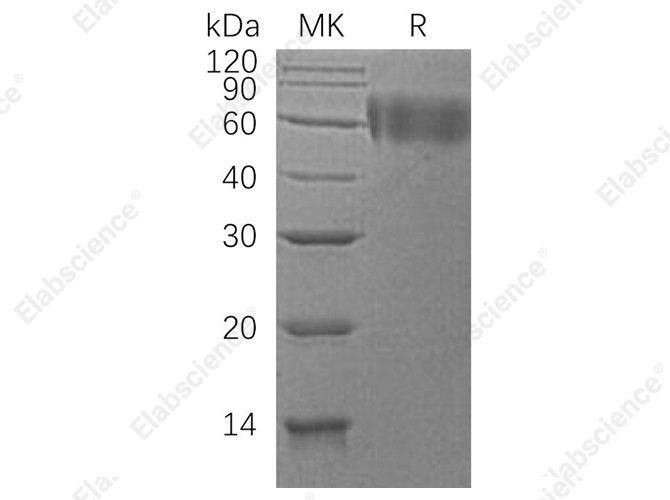 Recombinant Human DR6/TNFRSF21 Protein (His Tag) - 1