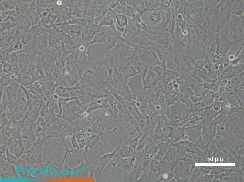 Mouse Scleral Fibroblasts - 5