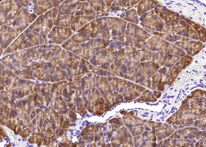 Recombinant Carboxypeptidase A2/CPA2 Monoclonal Antibody-searchlist-1